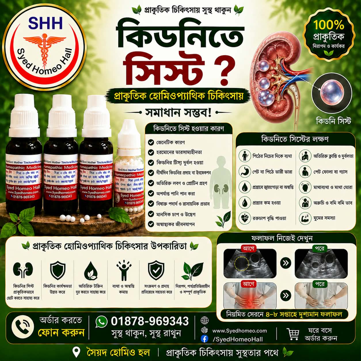 কিডনীতে সিস্ট